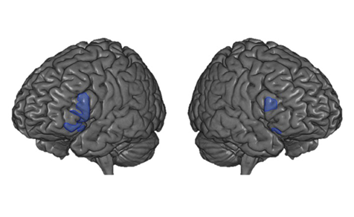 شكل 2 - في هذا الشكل، أنت تنظر إلى المخ من الجانب الأيسر (يسار اللوحة) والجانب الأيمن (يمين اللوحة).