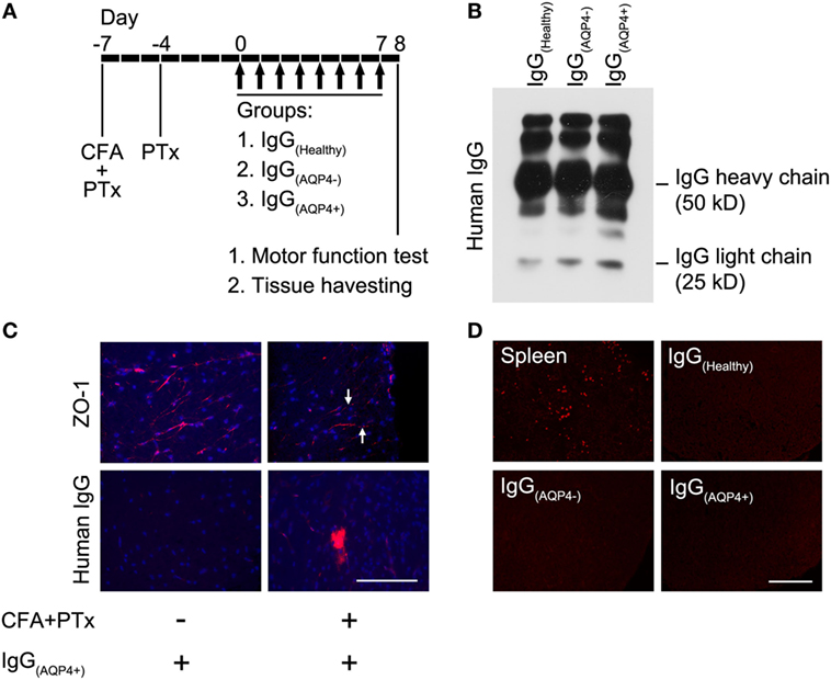 Multiple sclerosis: Serum anti-CNS autoantibodies - John W Prineas