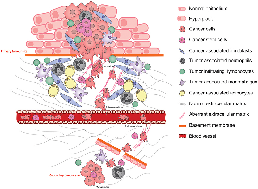 Basement membrane stiffness determines metastases formation