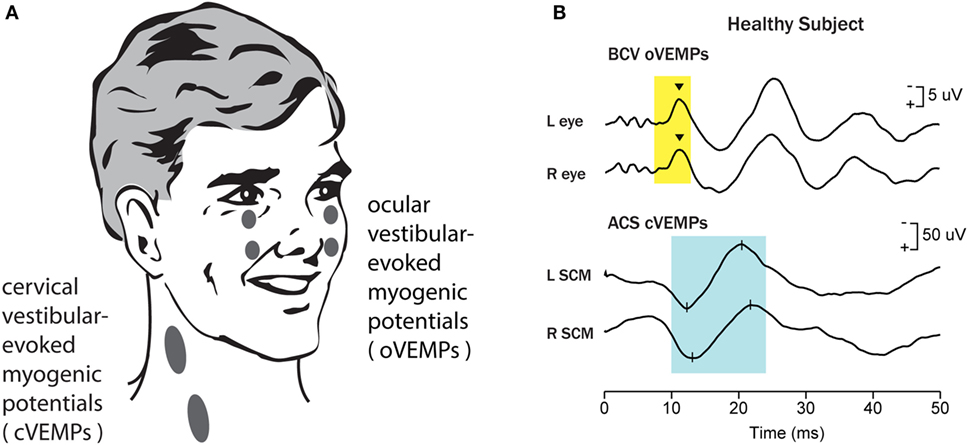 Frontiers | Otolithic Receptor Mechanisms for Vestibular-Evoked ...