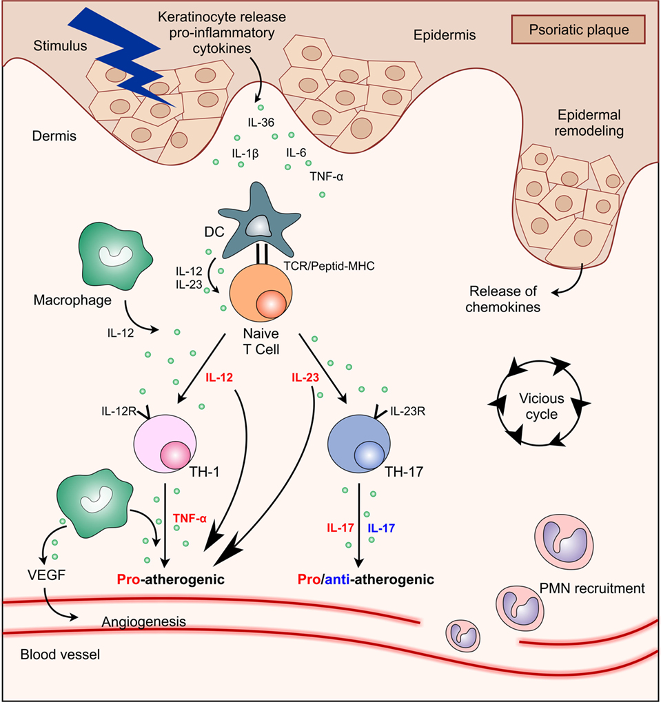 plaque psoriasis cardiovascular disease)