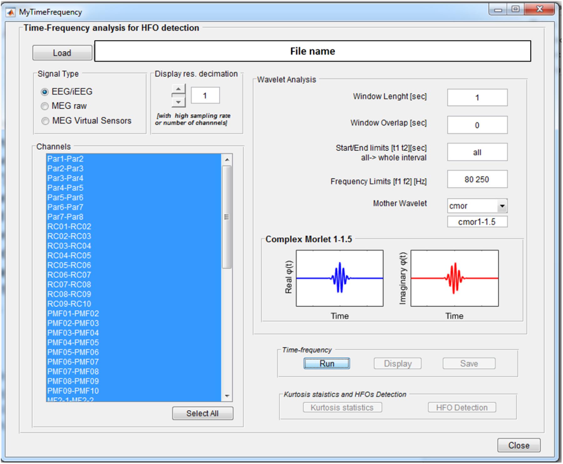 Frontiers | EPINETLAB: A Software for Seizure-Onset Zone Identification From Intracranial EEG ...