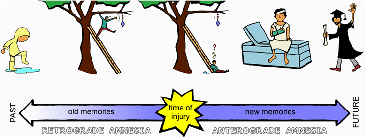 Figure 2 - Anterograde and retrograde amnesia.