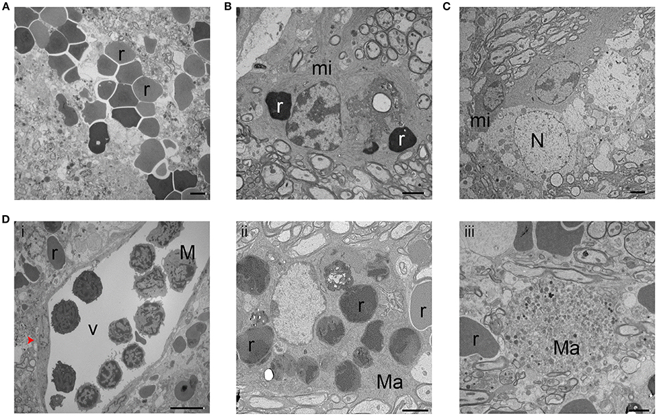 Frontiers | Ultrastructural Characteristics of Neuronal Death and White