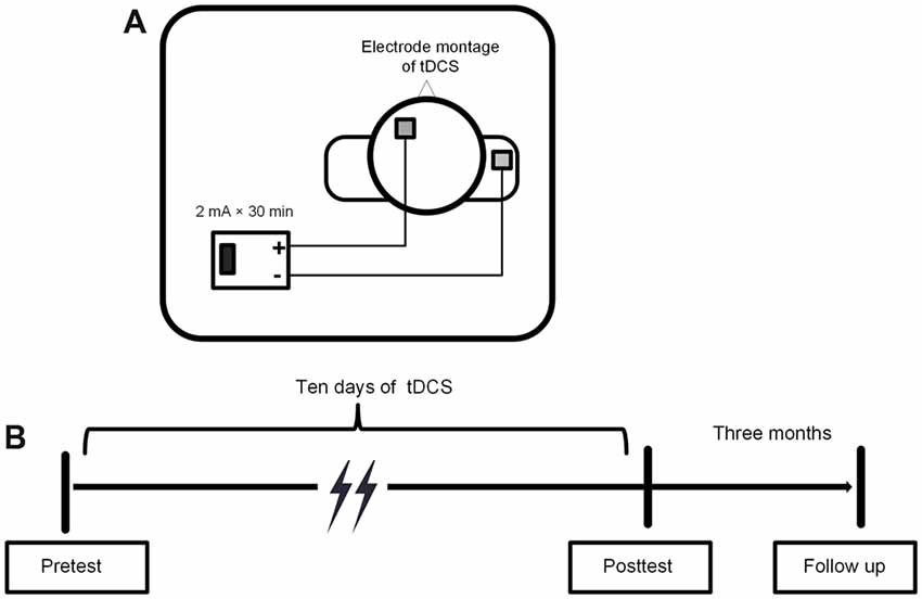 Tdcs Montage Chart