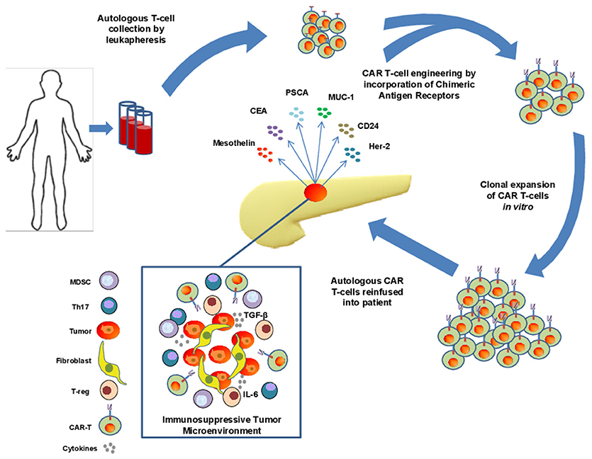 car t therapy pancreatic cancer