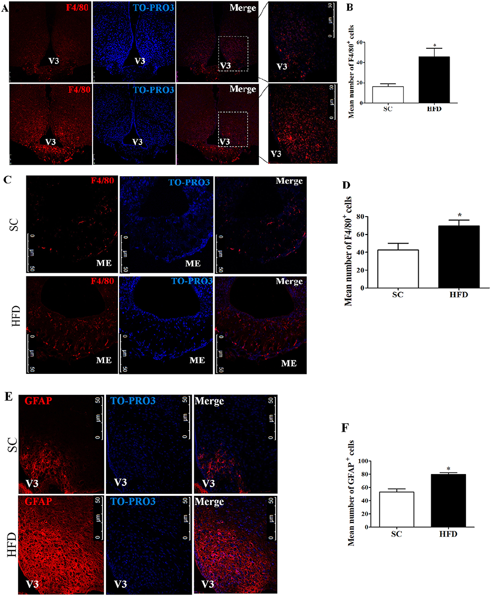 serotype for anti imflammatory diet