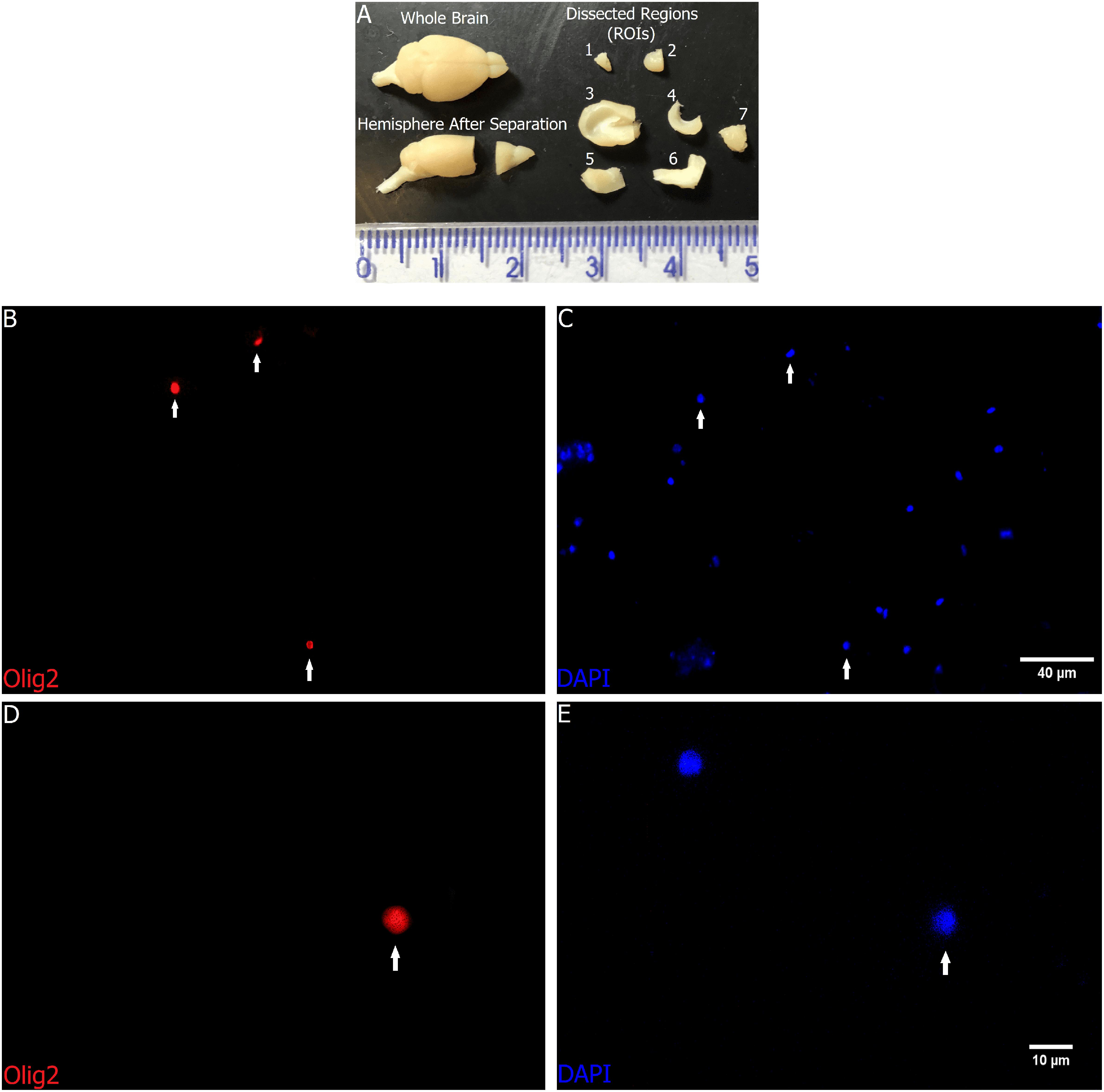 Frontiers The Absolute Number Of Oligodendrocytes In The