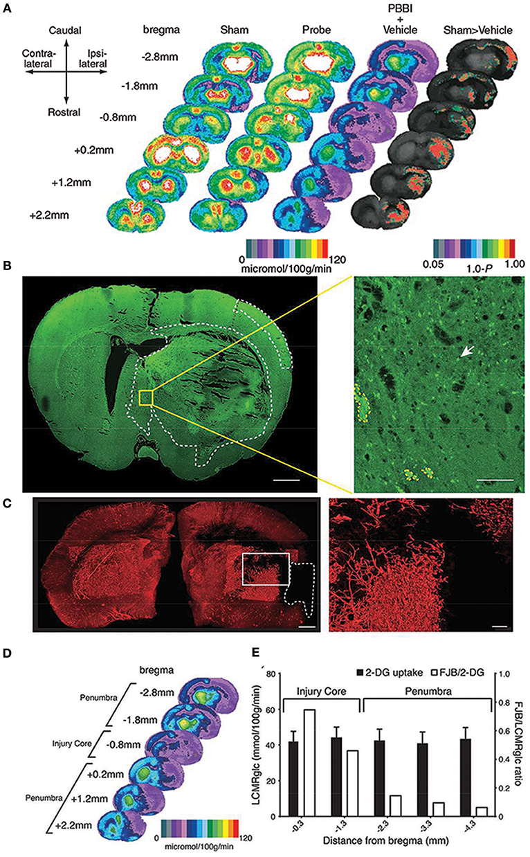 Erythropoietin in traumatic brain injury (EPO-TBI): a double-blind