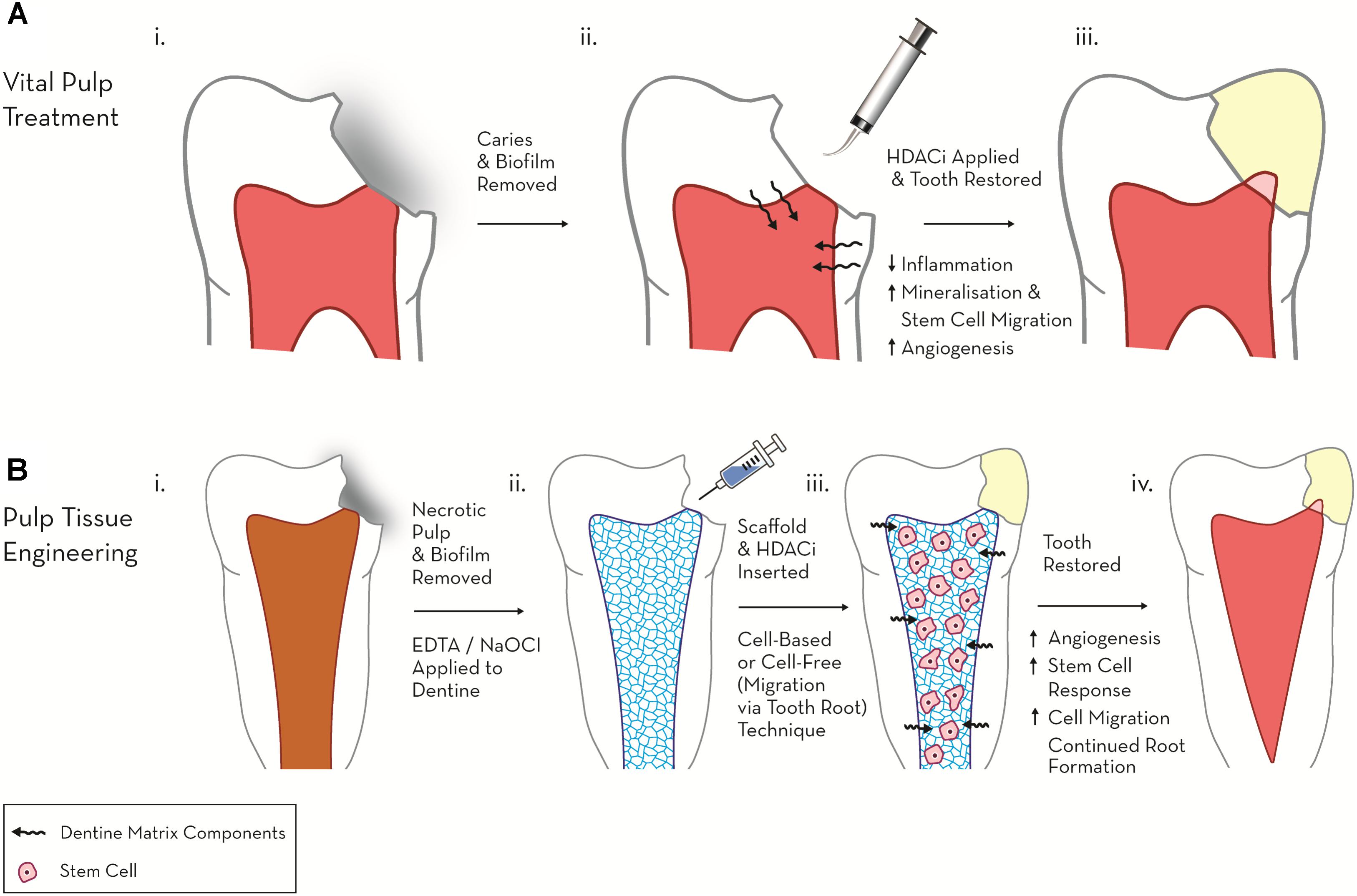 Mta Pulp Cap Mta Easier To Use Clinically As A Direct Pulp Capping 