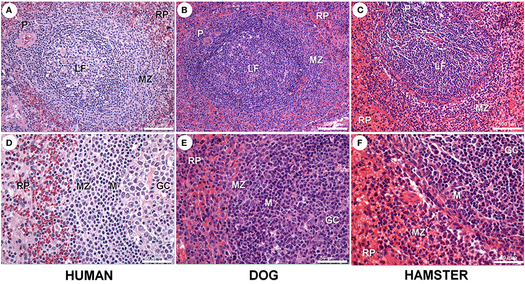 Frontiers  Histological Disorganization of Spleen Compartments and Severe  Visceral Leishmaniasis