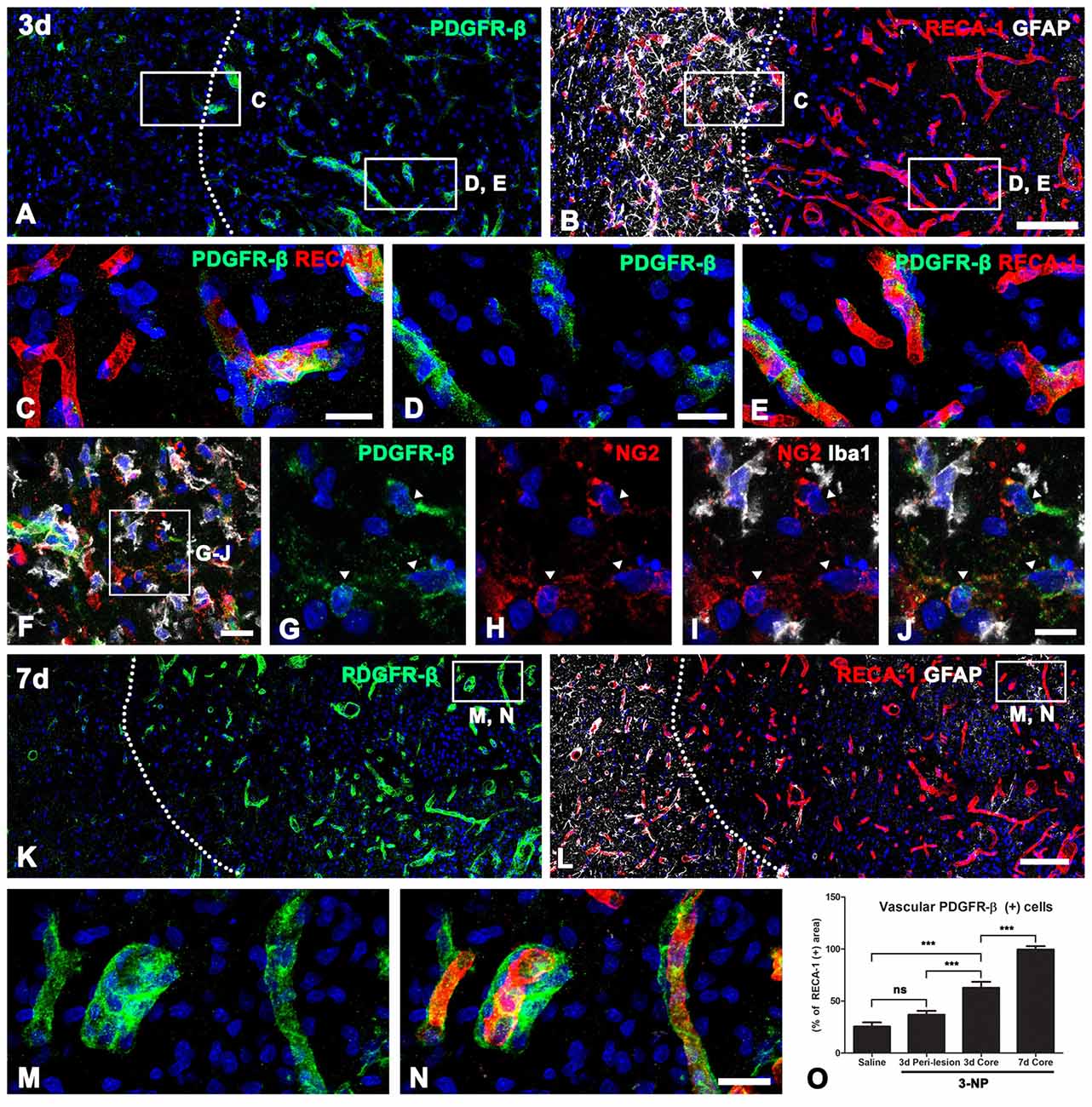 Frontiers | PDGFR-β-Positive Perivascular Adventitial Cells Expressing ...