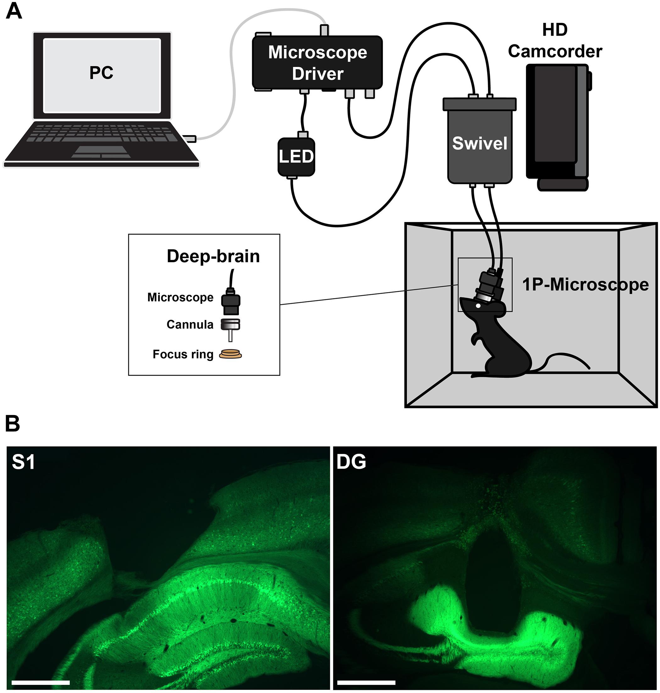 Using Baseplating and a Miniscope Preanchored with an Objective Lens for  Calcium Transient Research in Mice