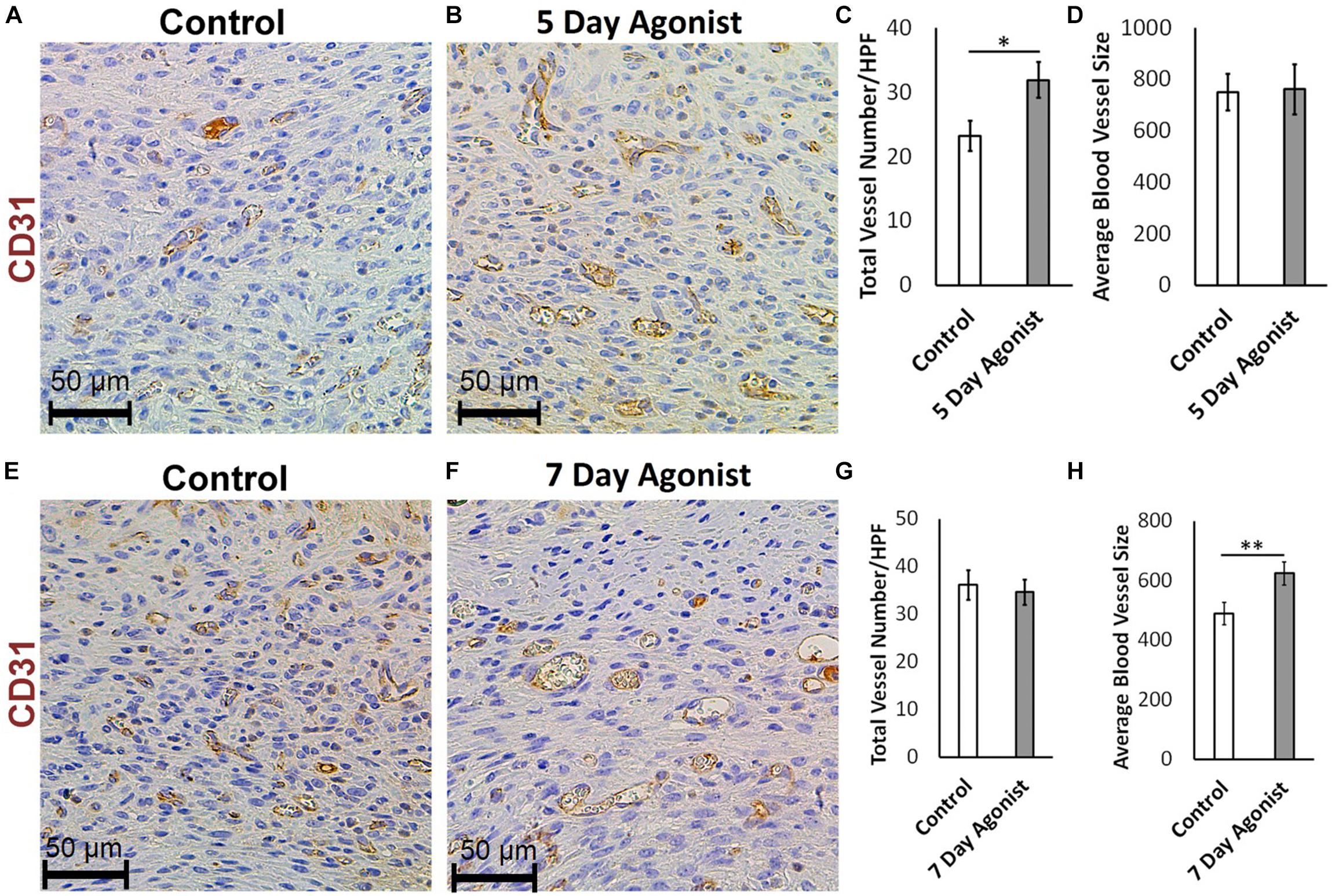 Frontiers | 5-HT1A Receptor Function Makes Wound Healing a
