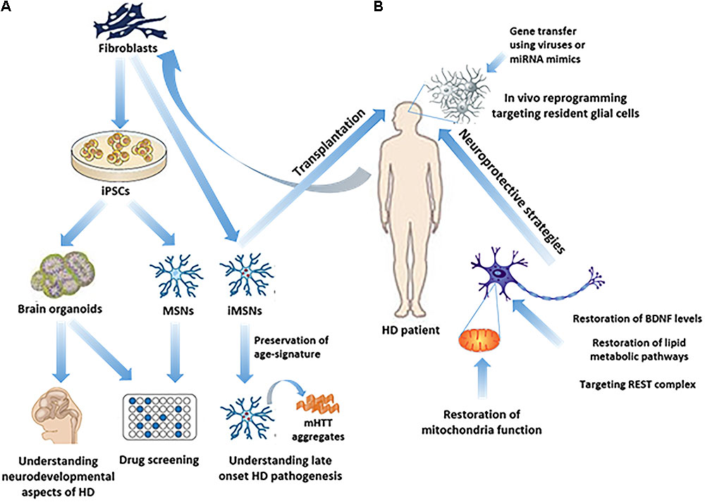 huntingtons disease treatment