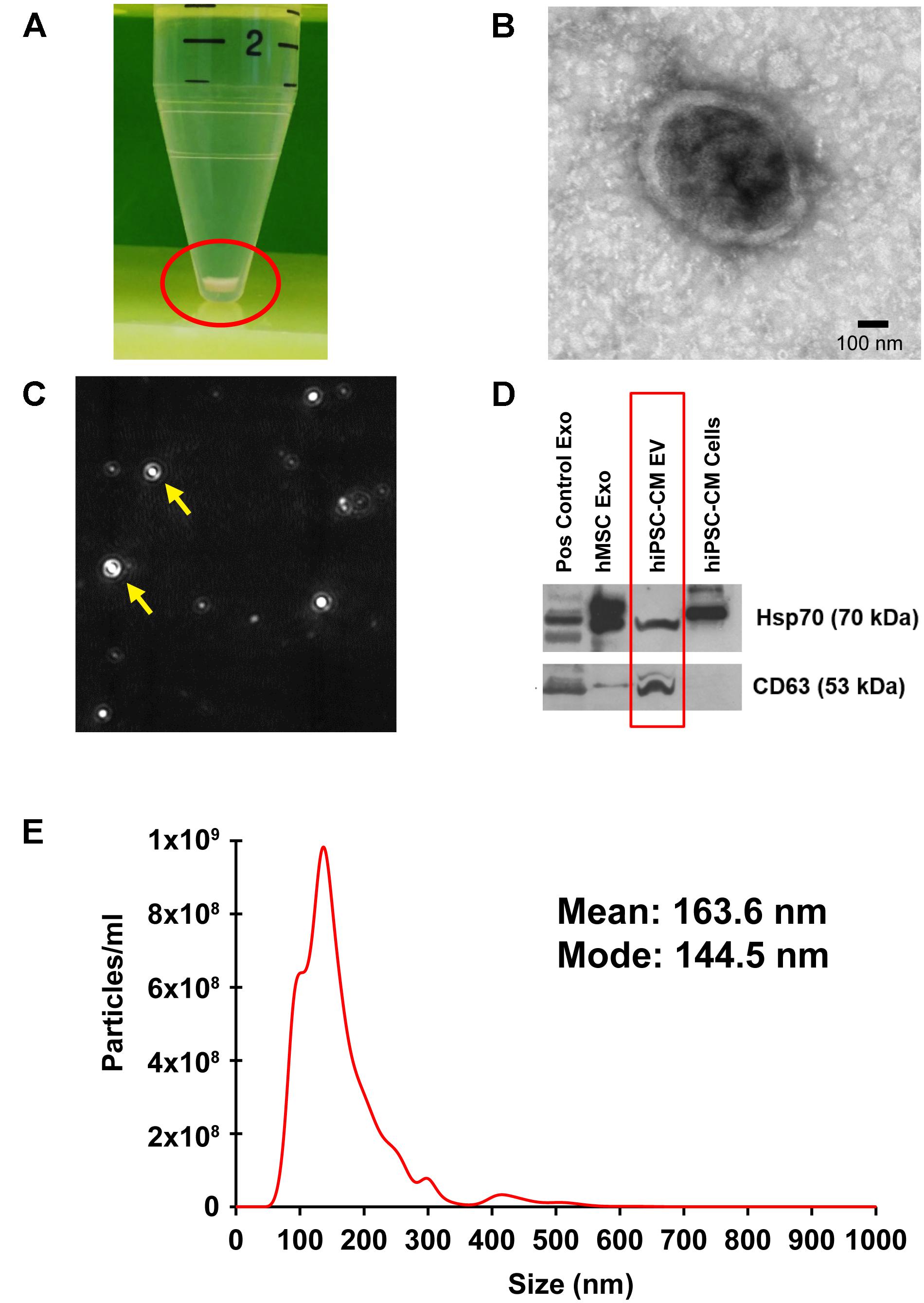 Frontiers | Extracellular Vesicles Released by Human Induced Frontiers | Extracellular Vesicles Released by Human Induced