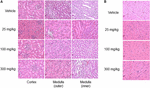 Identification of the Toxicity Pathways Associated With Thioacetamide-Induced Injuries in Rat Liver and Kidney