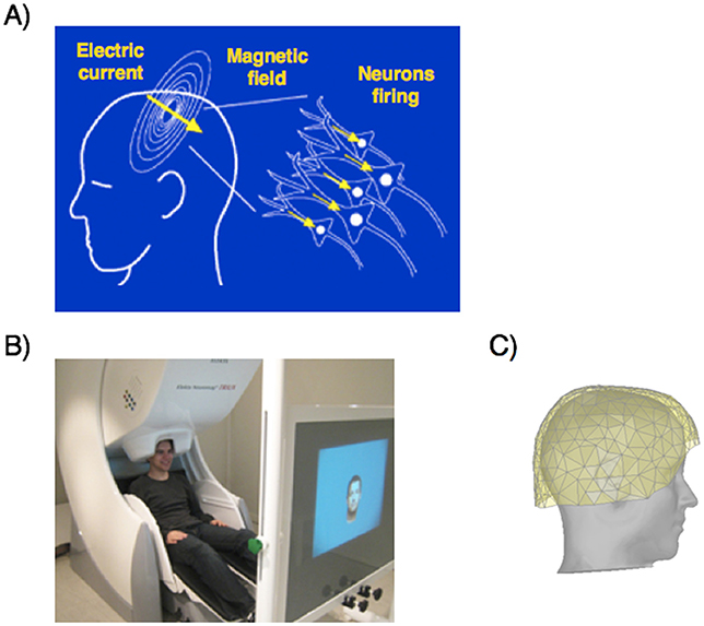 Figure 2 - (A) MEG measures brain activity by detecting the change in magnetic field produced by millions of brain cells (neurons) firing at the same time.