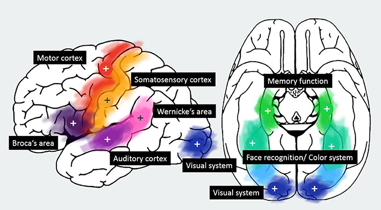 what color is the brain