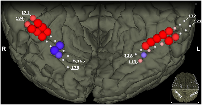 Figure 3 - These images show the bottom of the brain with its left and right sides.