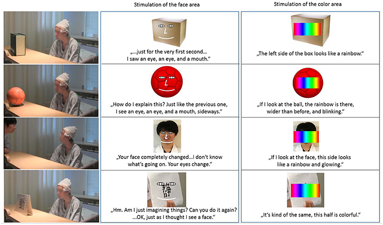 Figure 4 - While the patient viewed a black box, a basketball, Dr. Ogawa, or a sheet of paper with a Kanji character, the experimenter stimulated regions of the brain with very low electrical current.