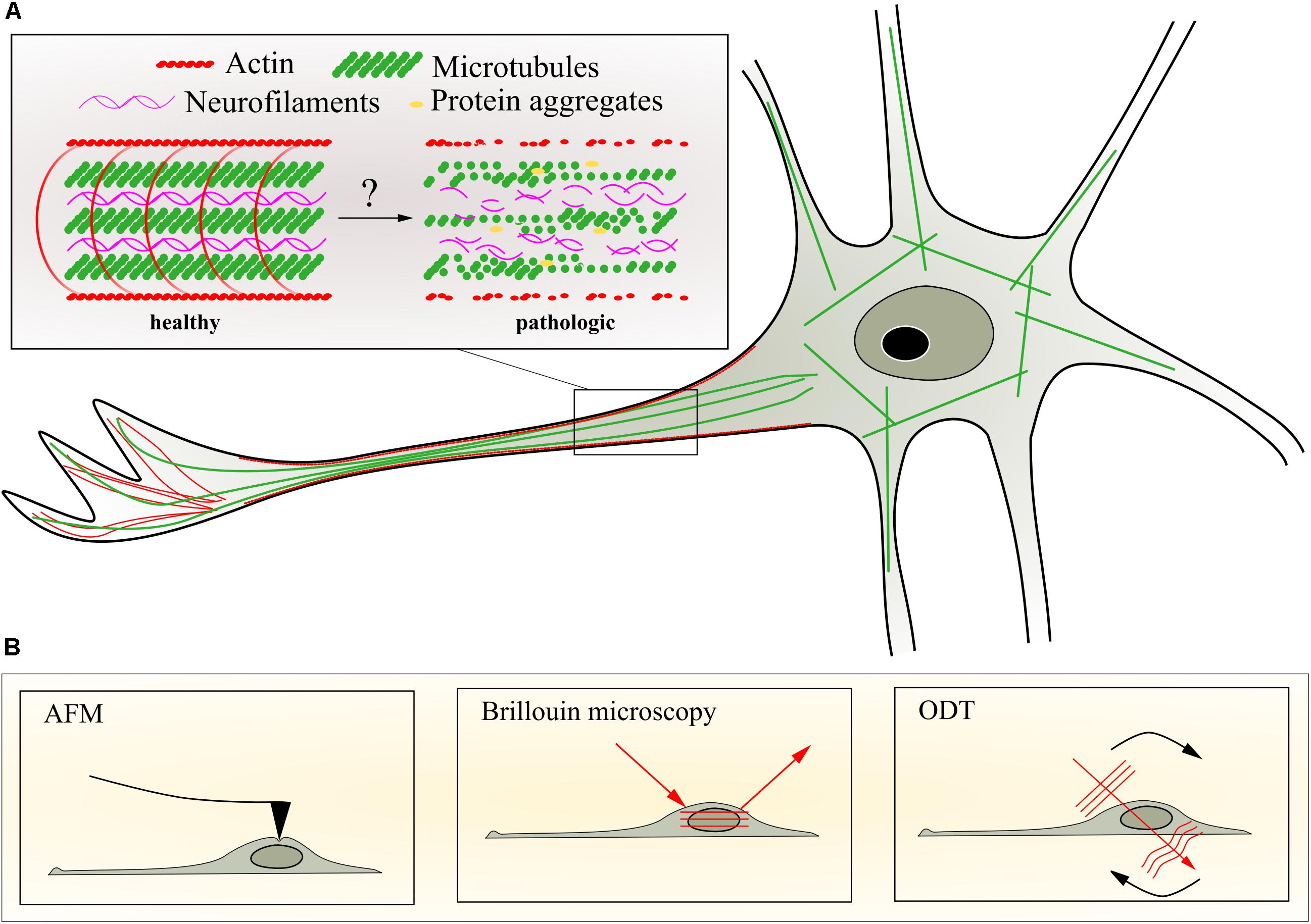 Frontiers | Axonal Transport, Phase-Separated Compartments, and Neuron ...
