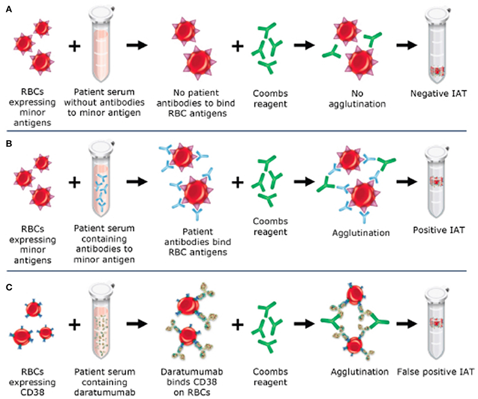 Frontiers Blood Transfusion Management for Patients Treated With Anti