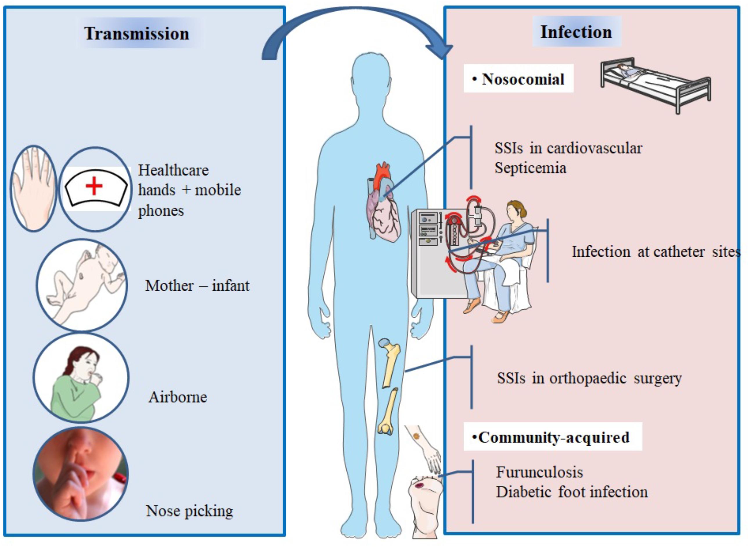 Frontiers  Selective Host Cell Death by Staphylococcus aureus: A Strategy  for Bacterial Persistence