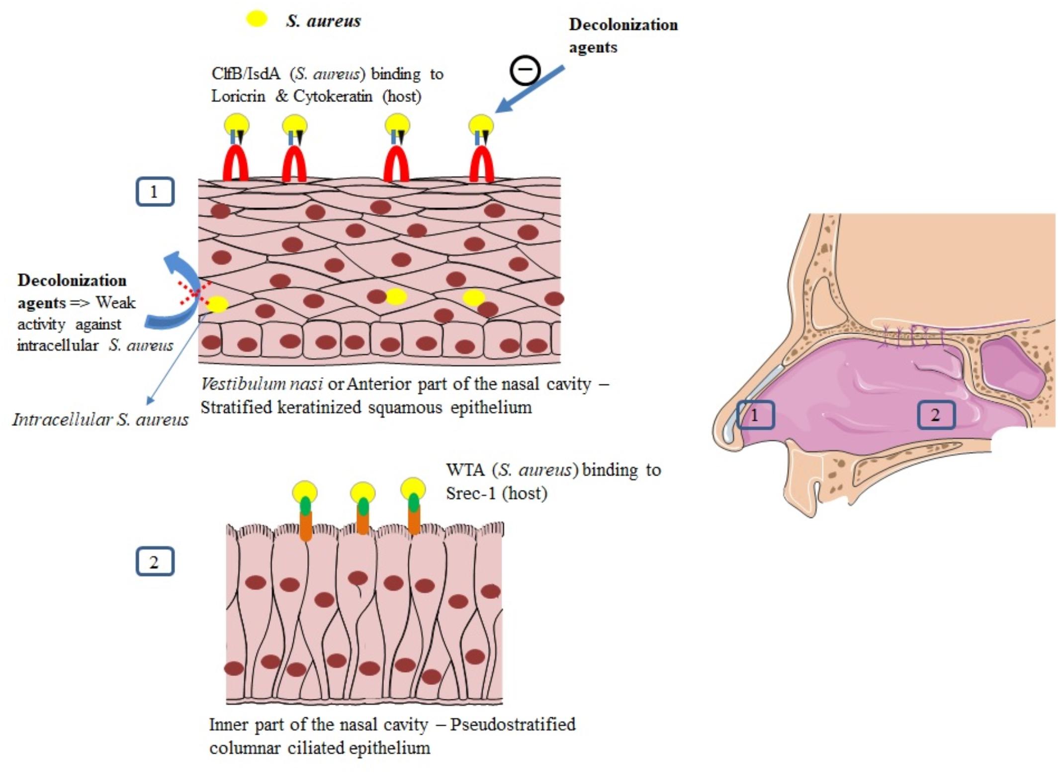 The role of nasal carriage in Staphylococcus aureus infections - The Lancet  Infectious Diseases