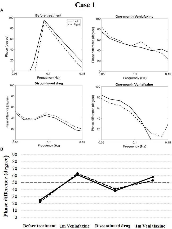 Narcolepsy Chart