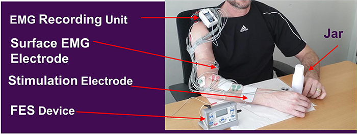 Neuromuscular Electrical Stimulation for Motor Restoration in Hemiplegia