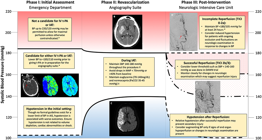 Retrospective evaluation of labetalol as antihypertensive agent in