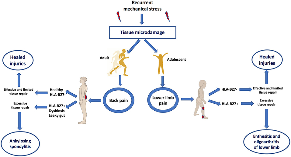 Figure 2. Mechanical stress as a trigger of tissue microdamage and back pai...