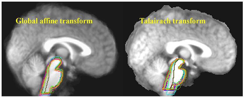 Frontiers Neuroinflammation And Cytokines In Myalgic Encephalomyelitis Chronic Fatigue Syndrome Me Cfs A Critical Review Of Research Methods Neurology