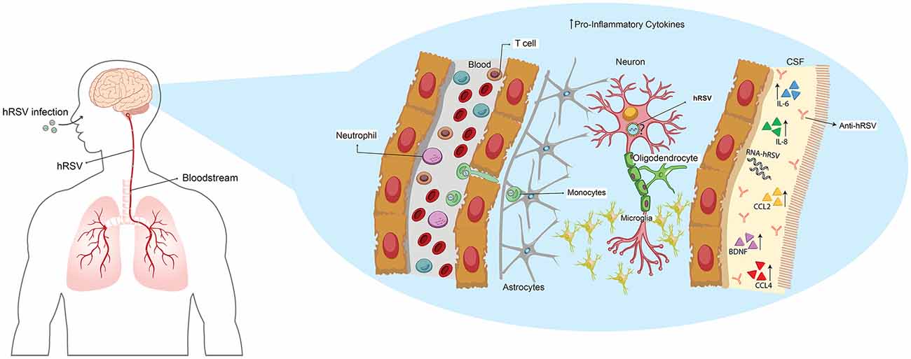 Frontiers | Neurologic Alterations Due to Respiratory Virus Infections