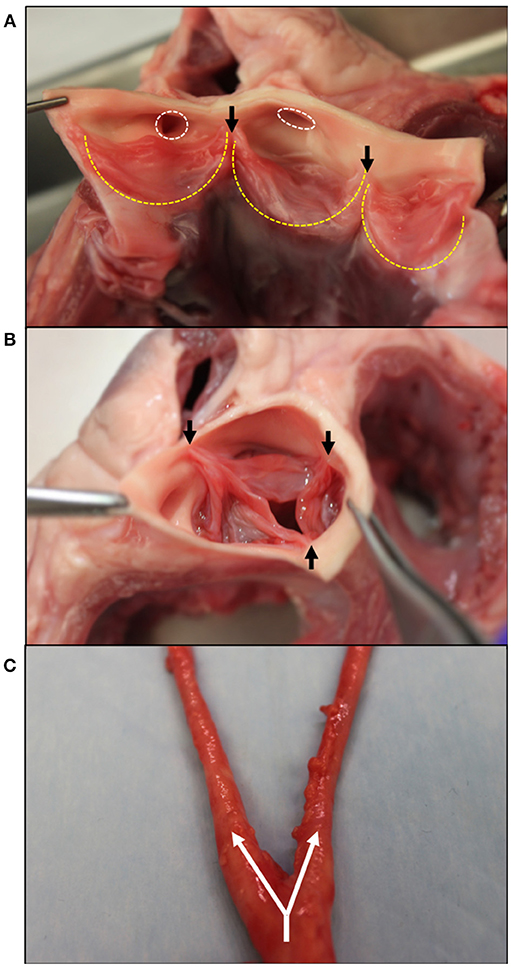 Frontiers | Comparing the Role of Mechanical Forces in Vascular and