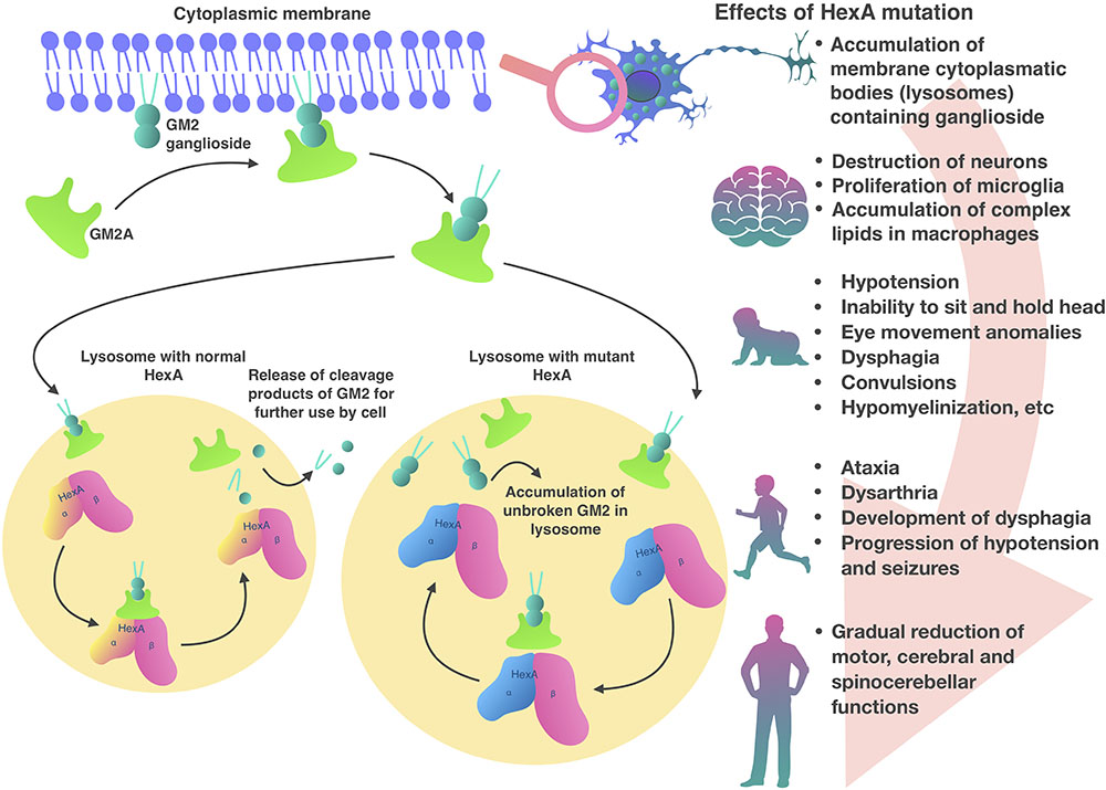 Strategies to combat Tay-Sachs disease - ScienceDirect