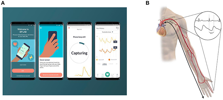 Cuffless Blood Pressure Monitors: Principles, Standards and