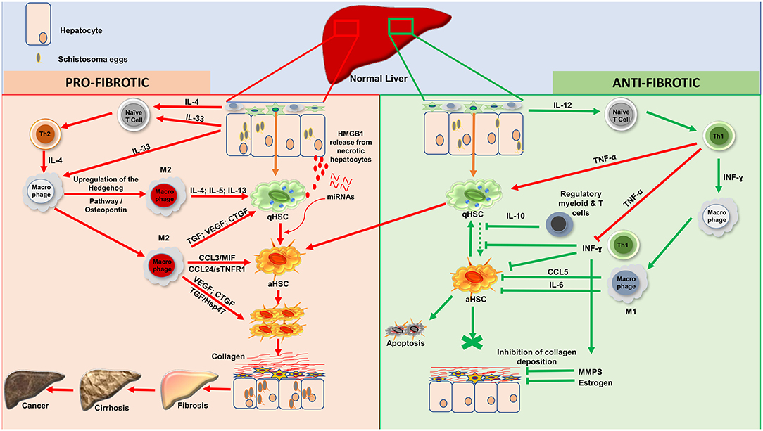 schistosomiasis of the liver