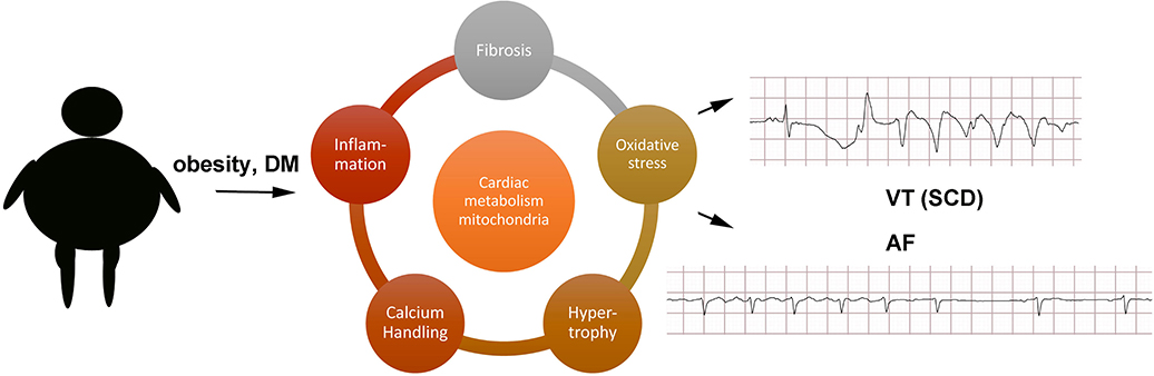 type 2 diabetes arrhythmia