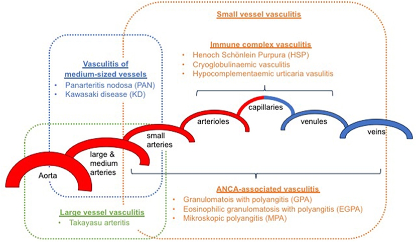 kawasaki arteritis