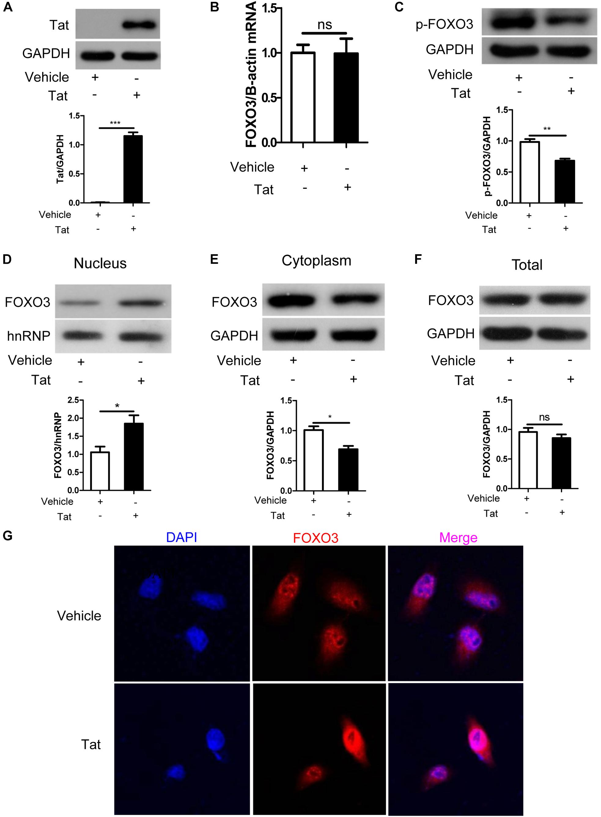 Role of FOXO3 Activated by HIV-1 Tat in HIV-Associated Neurocognitive Disorder Neuronal Apoptosis