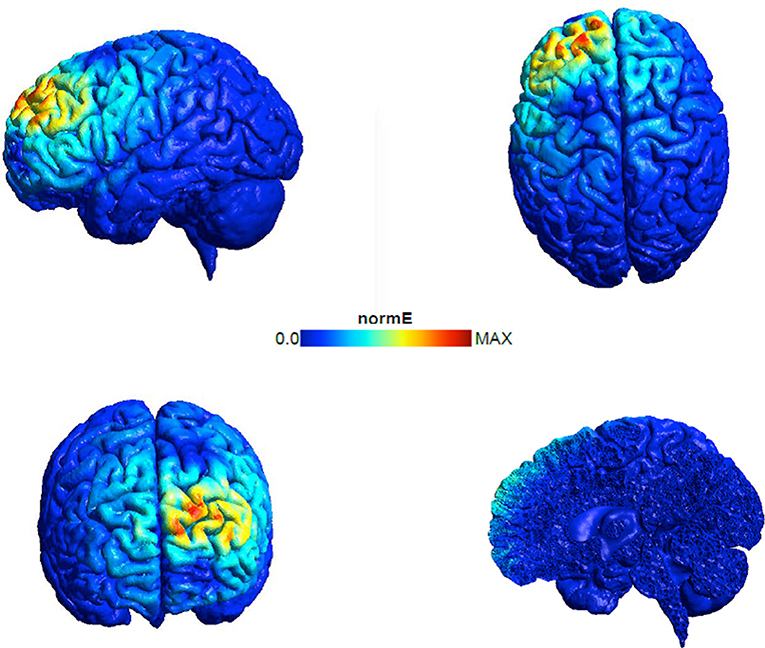 Мозг магнитное поле. Магнитное поле мозга. Мозг магнит. Brain help. Negative influence of the Magnetic field on the Human body.