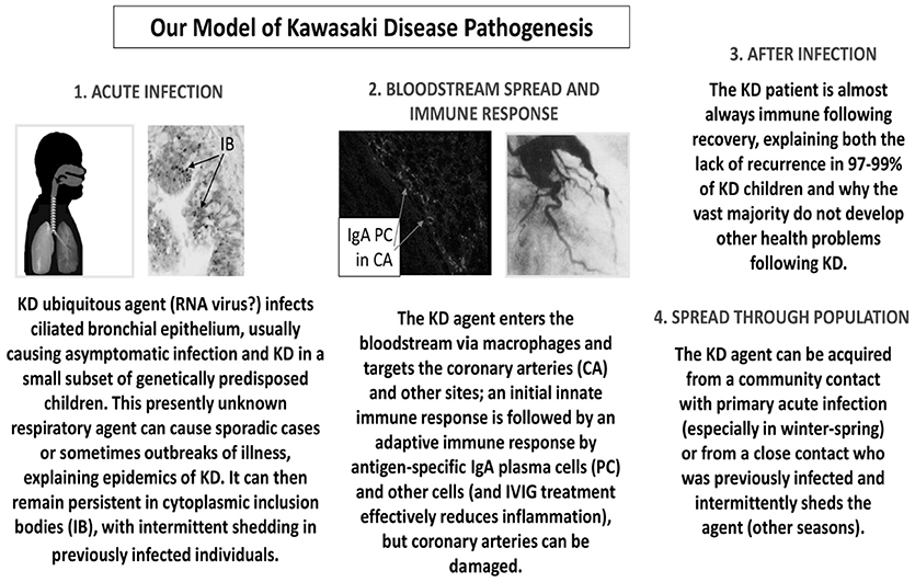 | The Epidemiology and Pathogenesis of Kawasaki Disease | Pediatrics