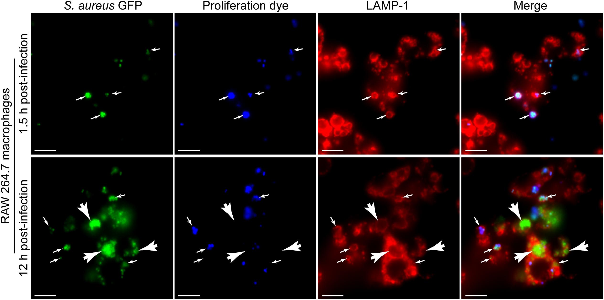Frontiers A Fluorescence Based Proliferation Assay For The Identification Of Replicating Bacteria Within Host Cells Microbiology Frontiers A Fluorescence Based Proliferation Assay For The Identification Of Replicating Bacteria Within Host Cells Microbiology