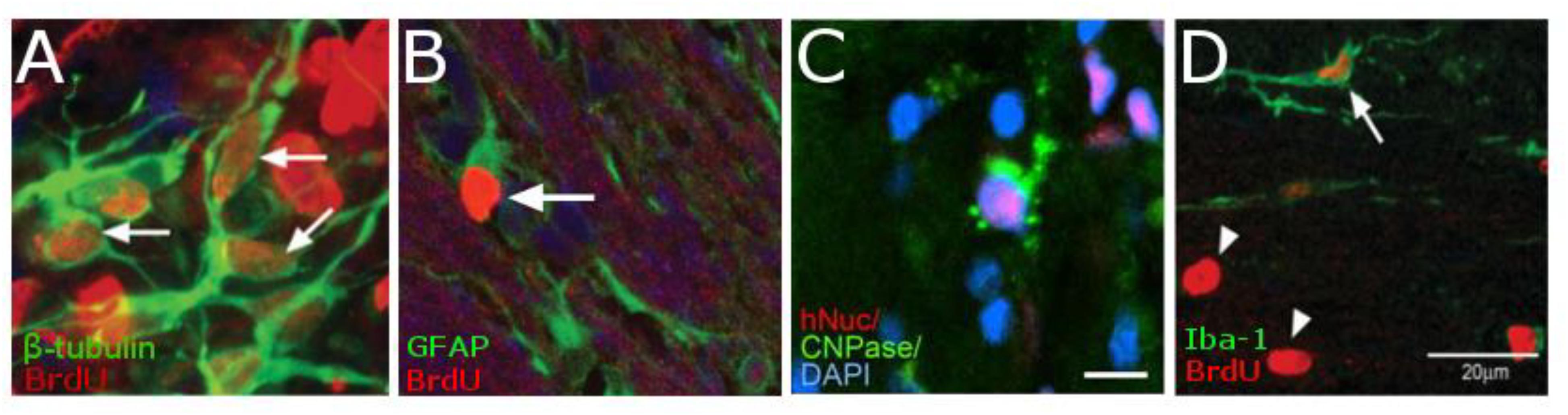 Frontiers | Tracking Neural Progenitor Migration the Rodent Brain Using Magnetic Resonance Imaging | Neuroscience