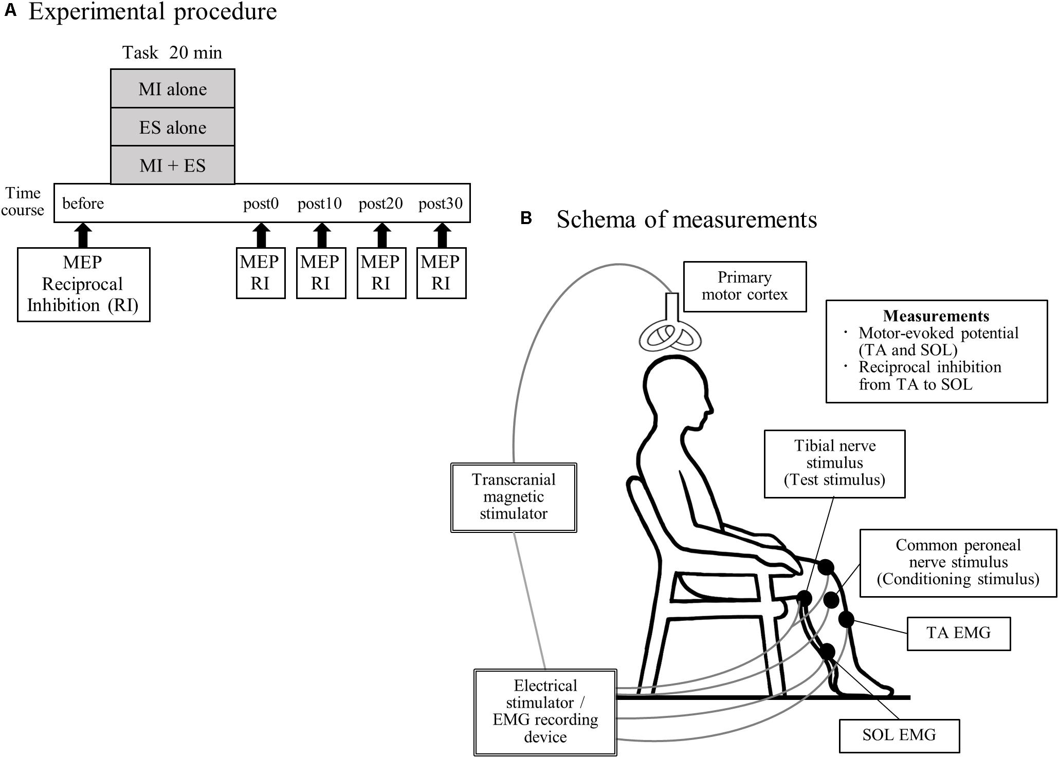 Electrical Stimulation - Progress Physical Therapy - Hale, MI