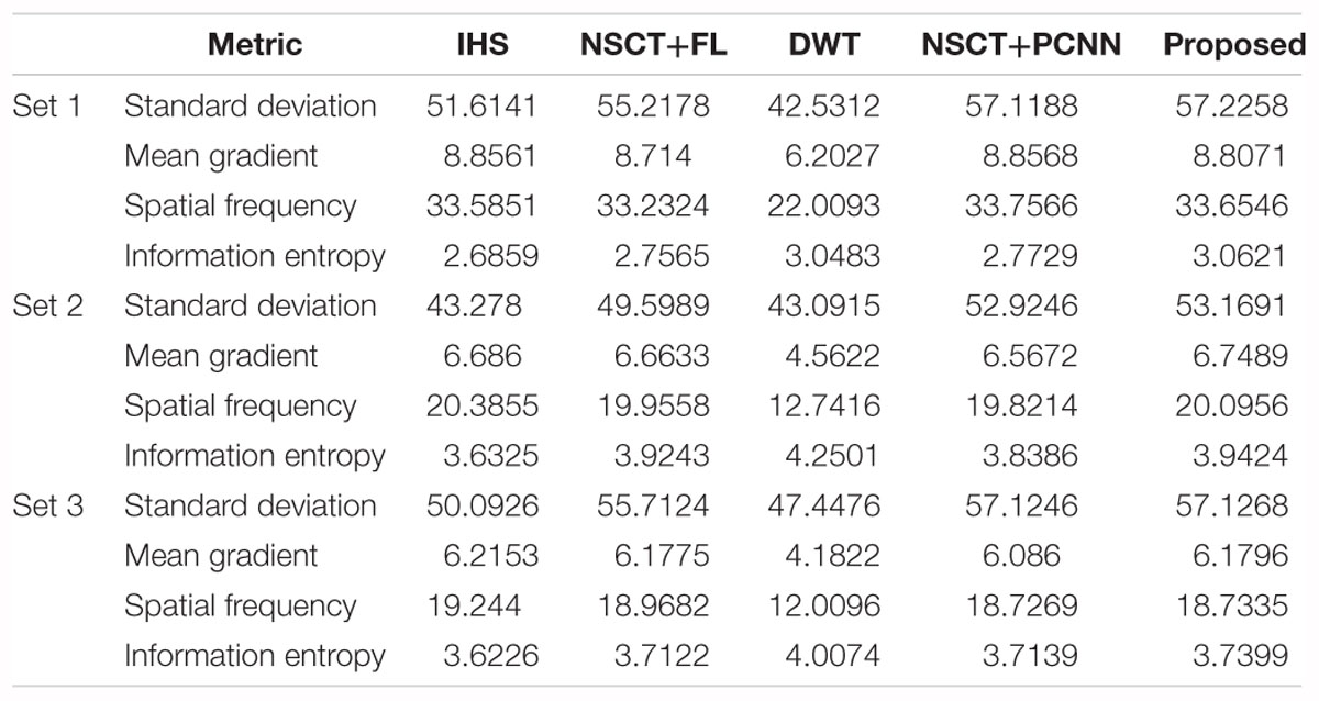 An Overview of Image Segmentation Based on Pulse-Coupled Neural Network