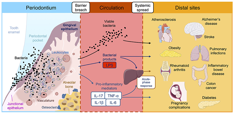 Inflammation and dental health