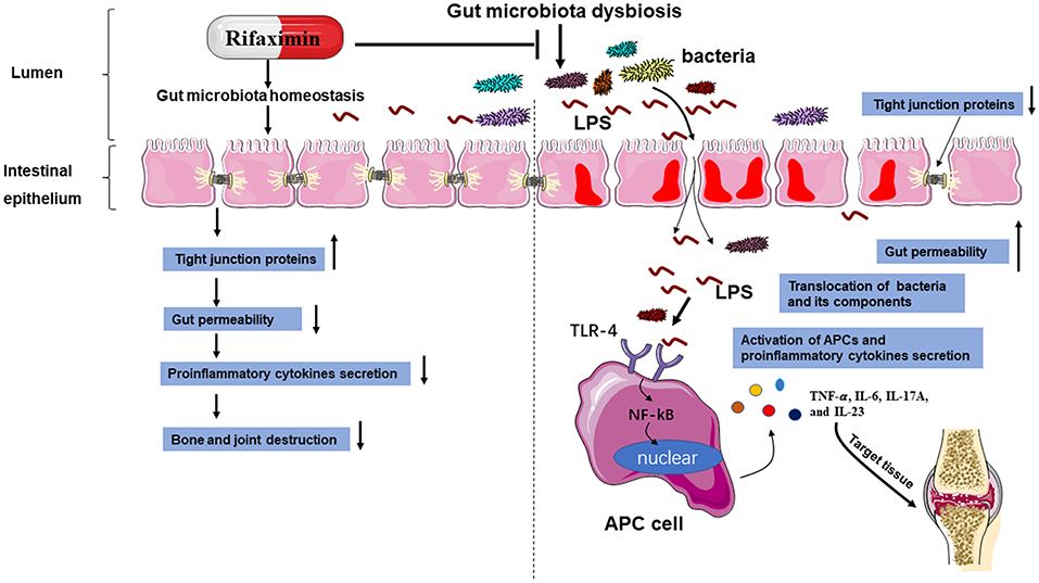 dysbiosis rifaximin)